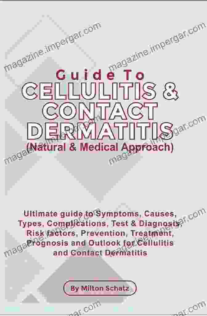 Guide To Cellulitis Contact Dermatitis Natural Medical Approach Guide To Cellulitis Contact Dermatitis (Natural Medical Approach)