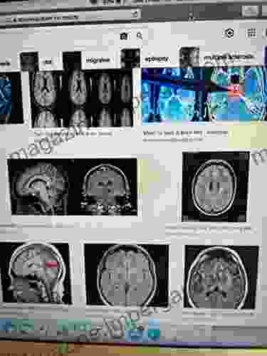 Brain Diseases Due To Deep Grooved Electrical Circuits With No Off Ramps // Psychology