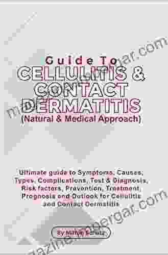 Guide To Cellulitis Contact Dermatitis (Natural Medical Approach)