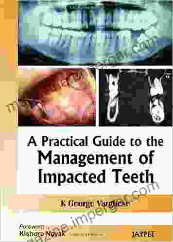 A Practical Guide to the Management of Impacted Teeth