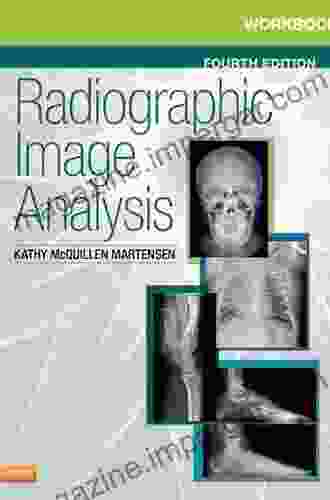 Workbook For Radiographic Image Analysis E